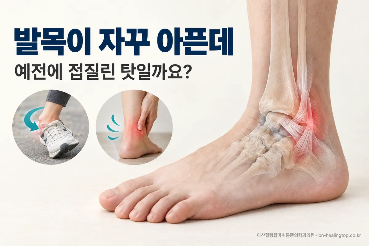 발목이 자꾸 아픈데, 예전에 접질린 탓일까요?