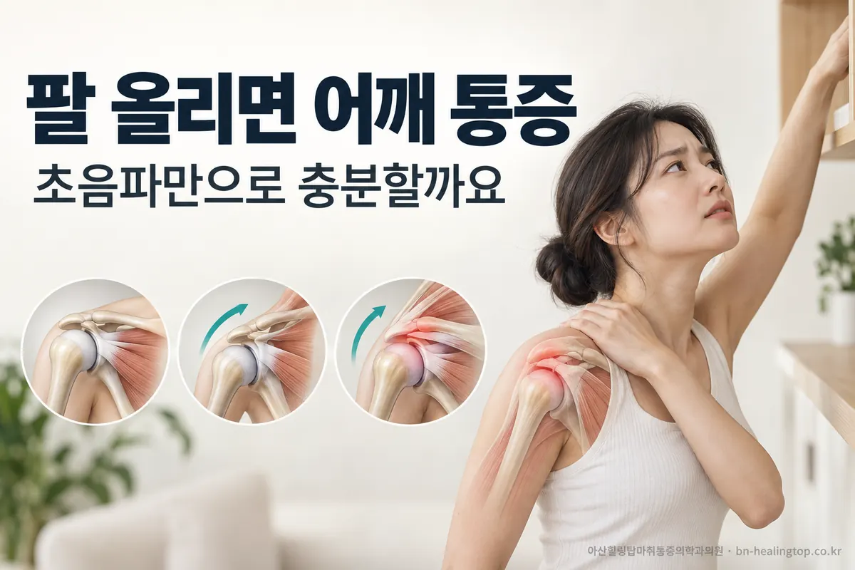 팔을 올리면 어깨가 아픈데, 초음파만 찍어 보면 될까요?